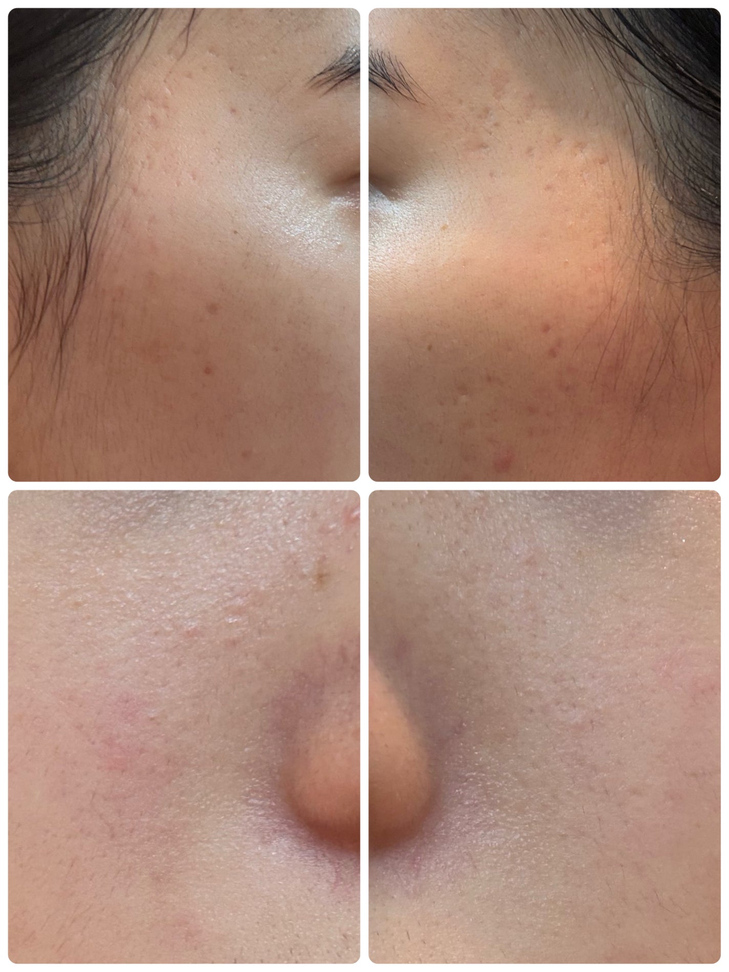 AGE-R ブースタープロ/MEDICUBE/美顔器・マッサージを使ったクチコミ(2枚目)