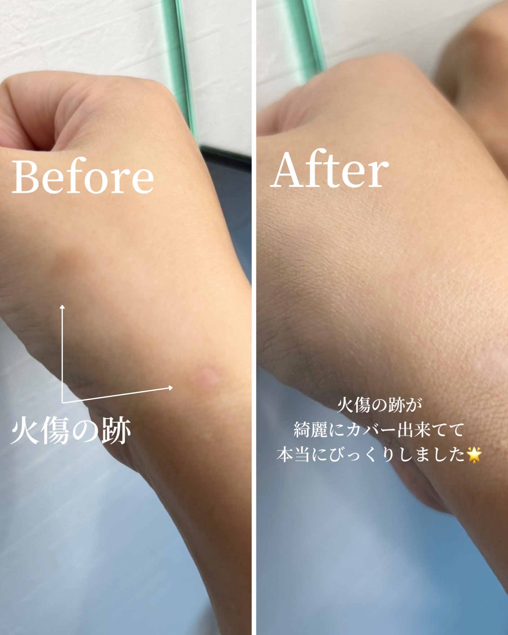 ロングラスティングチップコンシーラー/LUNA/リキッドコンシーラーを使ったクチコミ（3枚目）