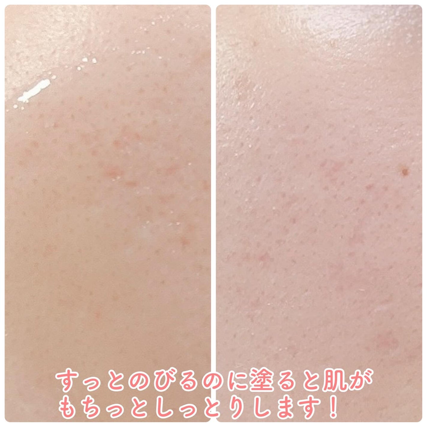 ビタミンアンプル2ml(5本入り)/Spela/美容液を使ったクチコミ(3枚目)