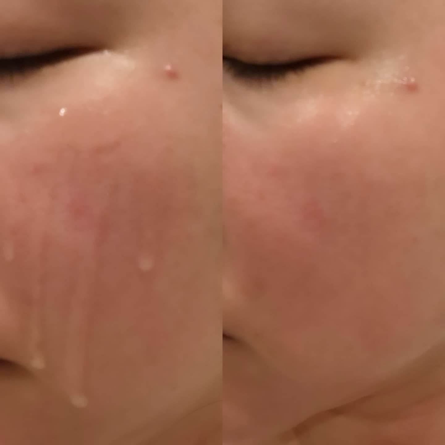 ノスカナイン T セラムマスク S/FATION/シートマスク・パックを使ったクチコミ（3枚目）