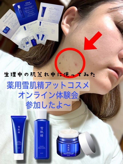 薬用雪肌精 ブライトニング エッセンス ローション/雪肌精/化粧水を使ったクチコミ(1枚目)