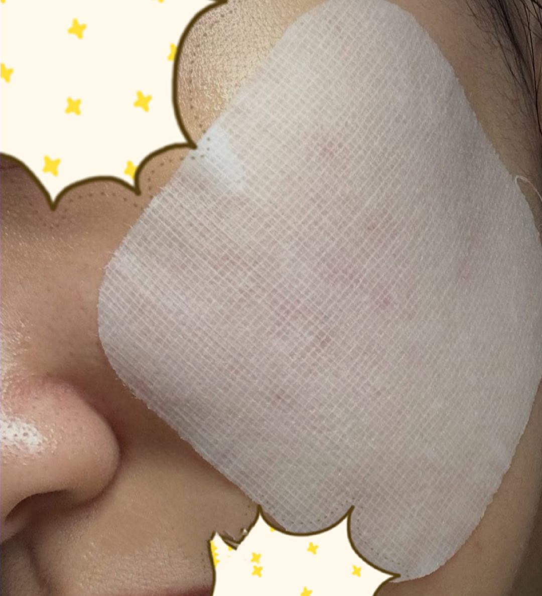 MEDIHEAL マデカッソシドブレミッシュパッドのクチコミ「MEDIHEAL
マデカソサイドブレミッシュパッド　　3190円

大容量サイズのガ―ゼマスク.....」（3枚目）