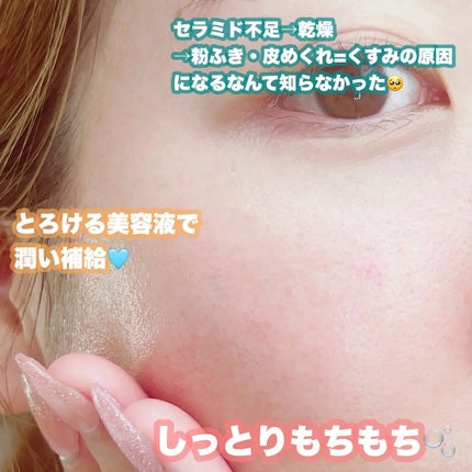 キュレル 潤浸保湿 泡美容液 【医薬部外品】/キュレル/美容液を使ったクチコミ(4枚目)