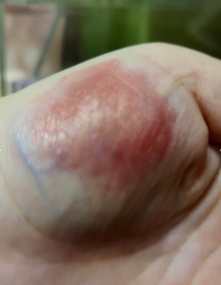 KM スティックチーク/Kyumme/ジェル・クリームチークを使ったクチコミ(4枚目)