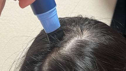 Scalp Root Calm & Barrier(コンブ一体型+リフィル セット)/ANDKWAN/スカルプブラシを使ったクチコミ(2枚目)