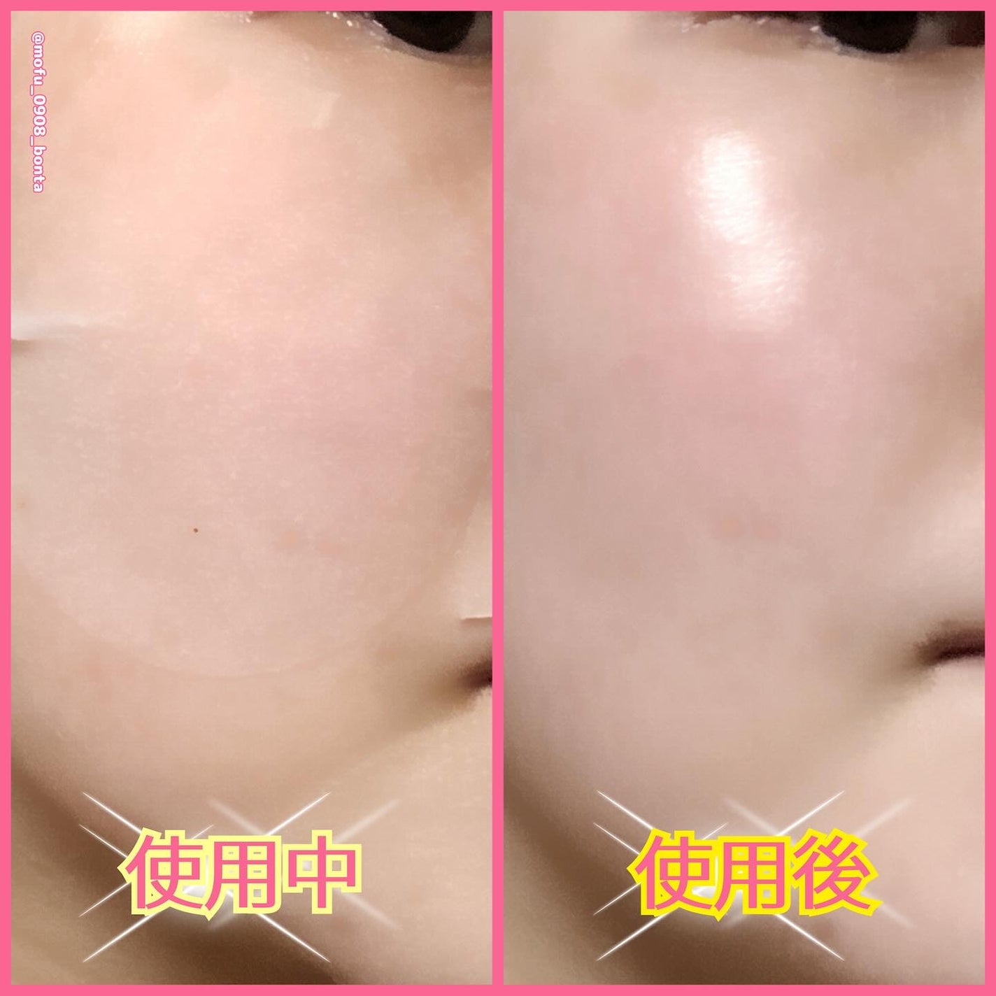 ツボクサ エッセンス/mixsoon/美容液を使ったクチコミ(4枚目)