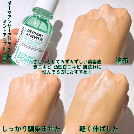 ダーマアンサーアゼライン酸ミントアンプル/CNP Laboratory/美容液を使ったクチコミ(3枚目)