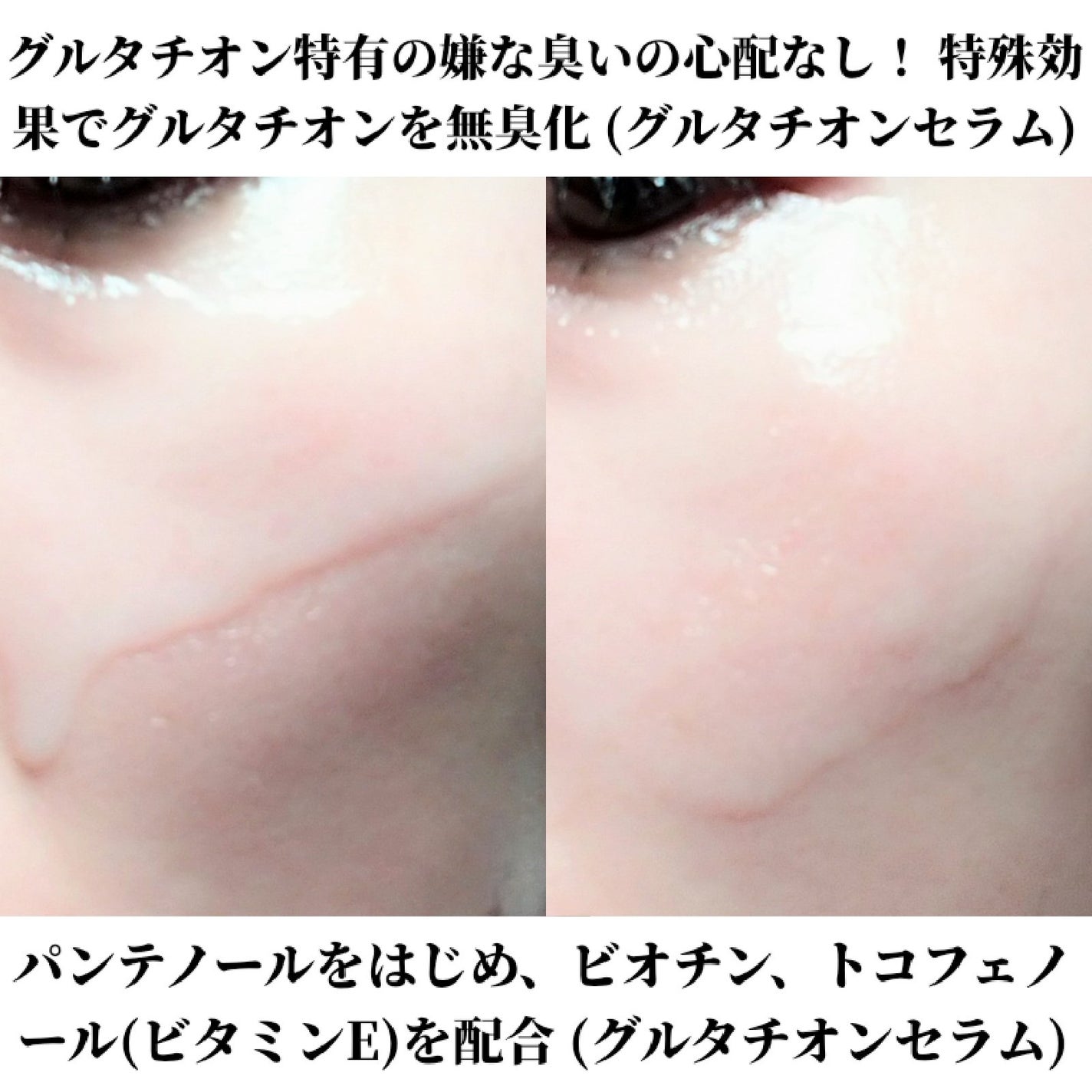 グルタチオンラディアンスセラム/SKIN&LAB/美容液を使ったクチコミ(2枚目)