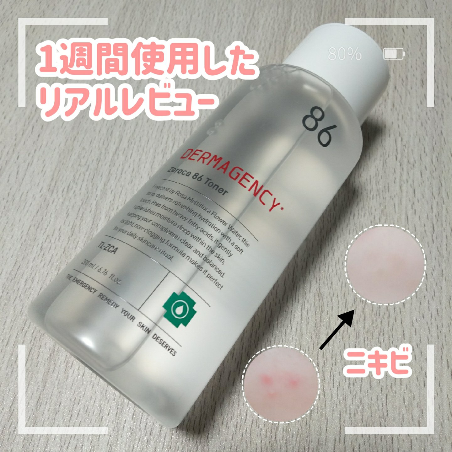 ダーマジェンシー ゼロカ86 トナー/DERMAGENCY/化粧水を使ったクチコミ（1枚目）