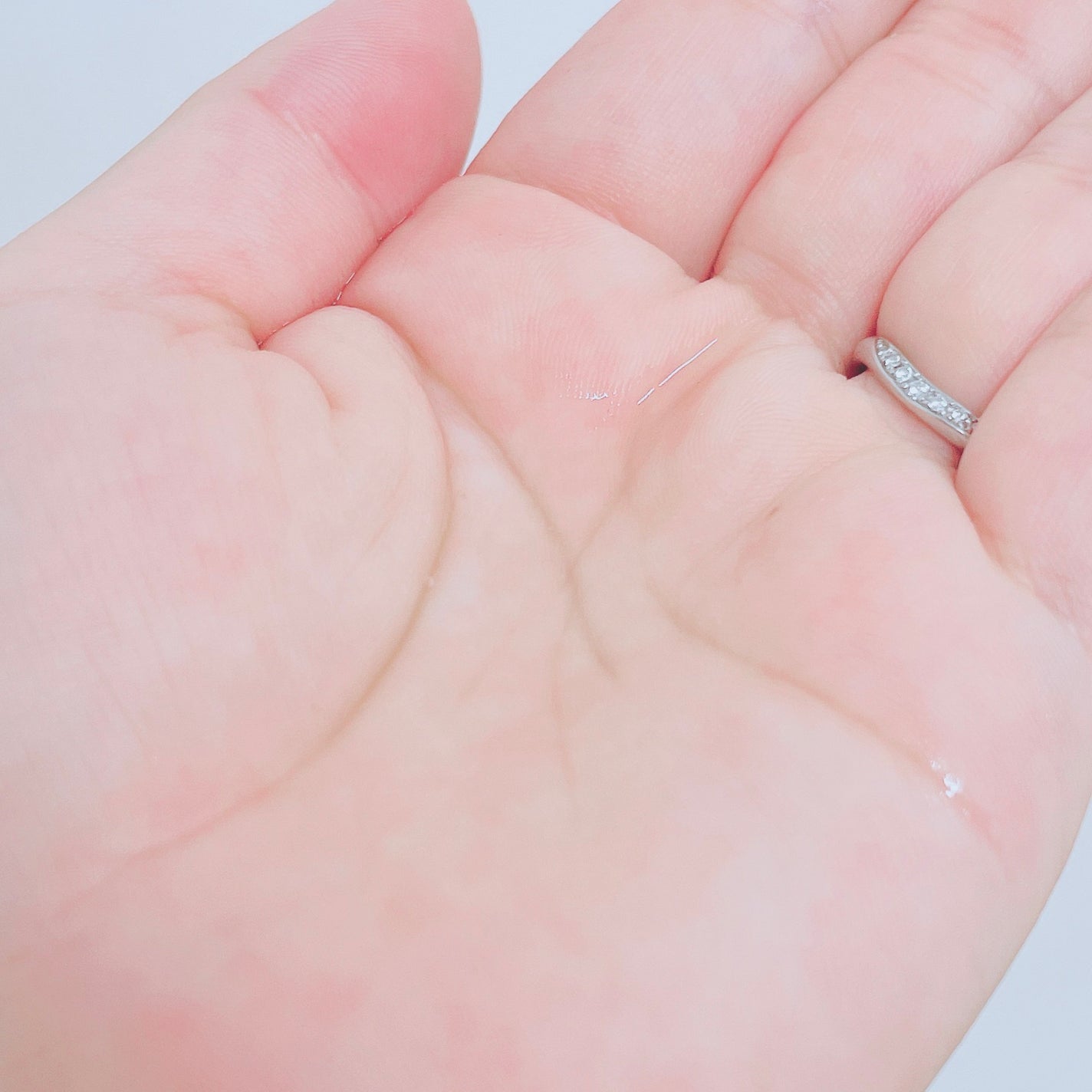 VC100エッセンスローション EX/ドクターシーラボⓇ/化粧水を使ったクチコミ(5枚目)