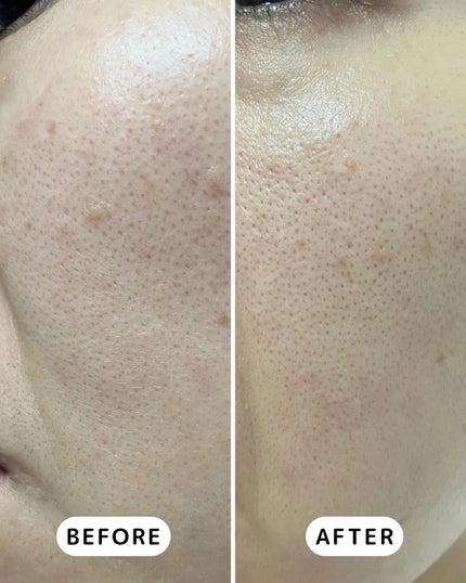 Ultra Whitening Perfect Ampoule/MIGUHARA/美容液を使ったクチコミ(4枚目)