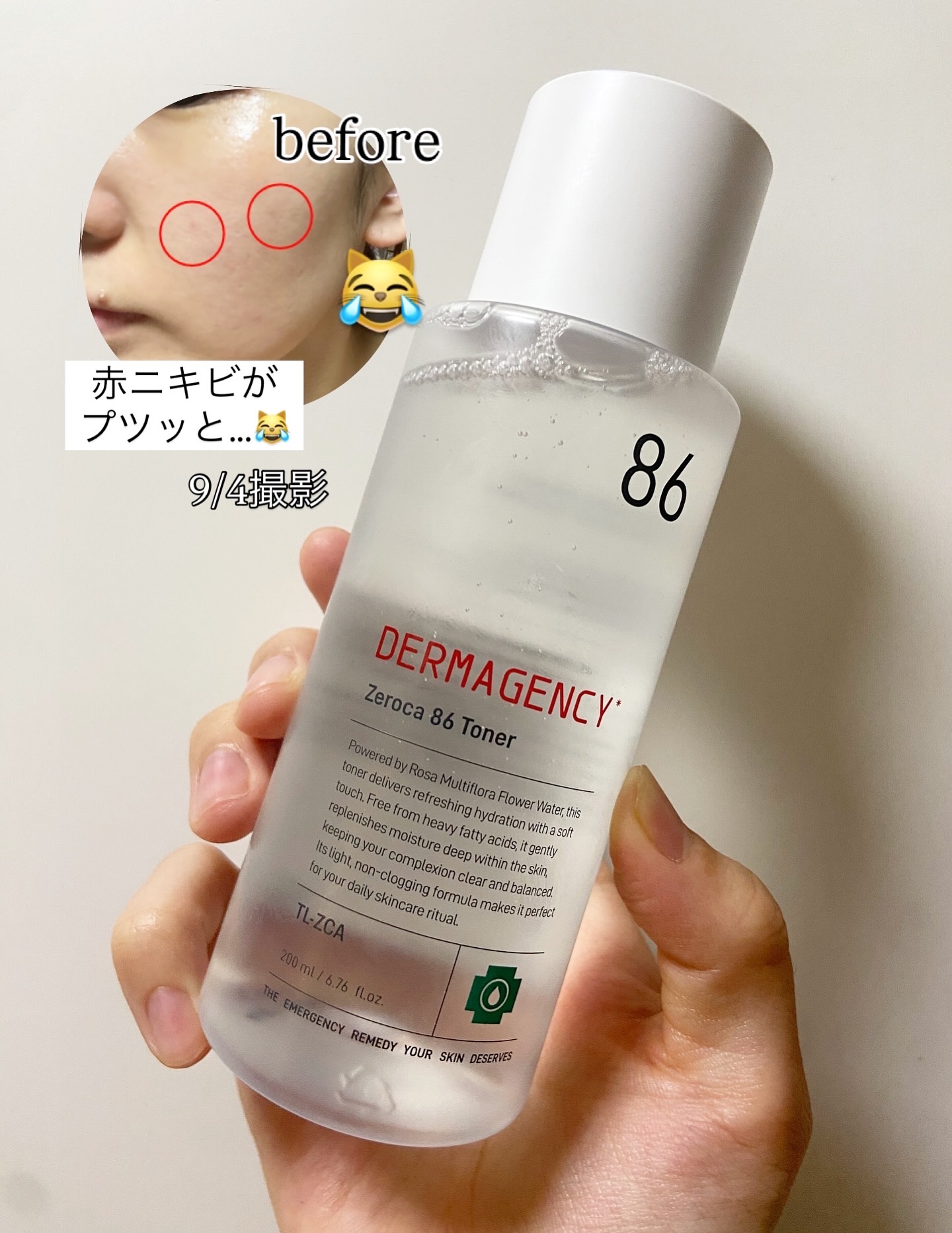 ダーマジェンシー ゼロカ86 トナー/DERMAGENCY/化粧水を使ったクチコミ（2枚目）