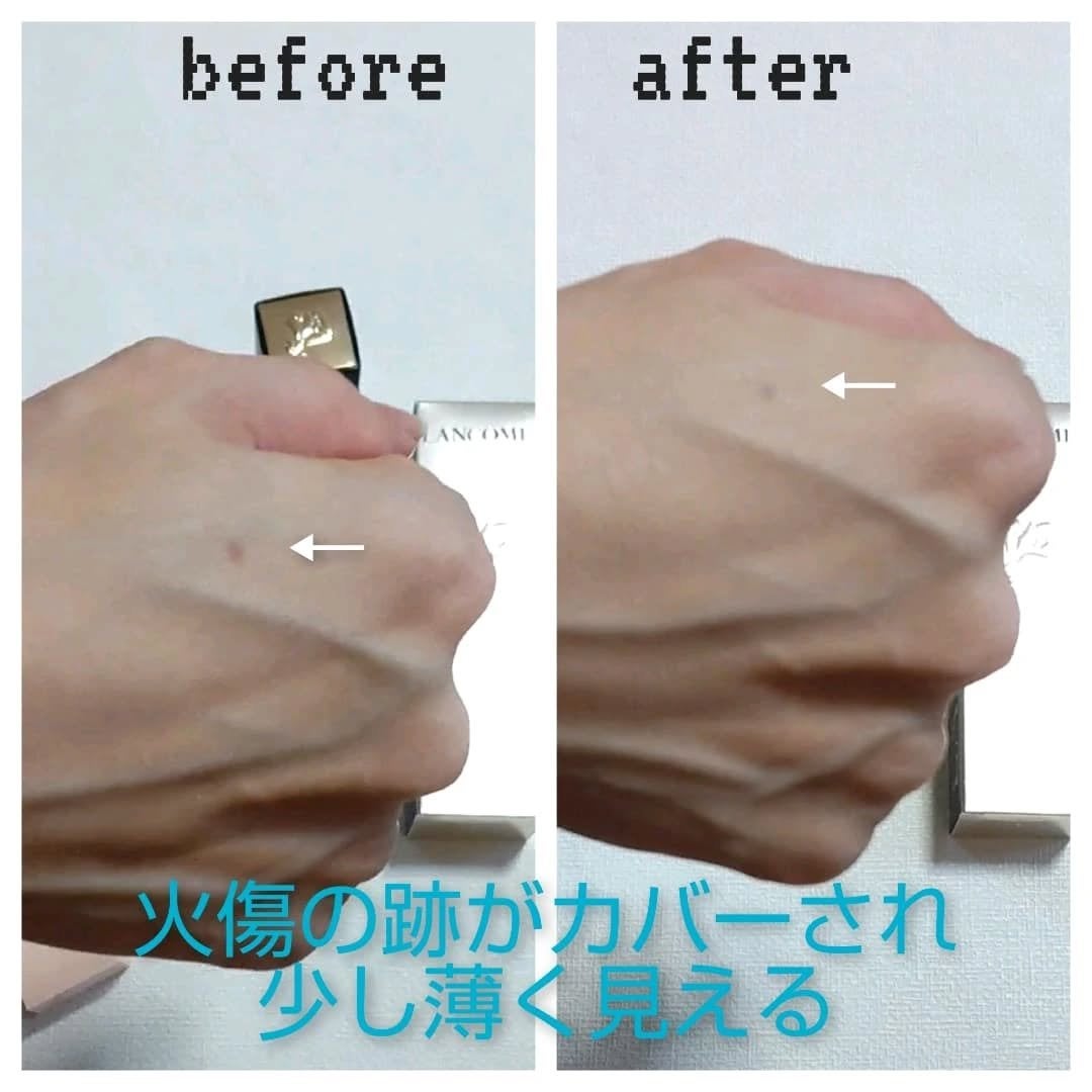 タンイドル ウルトラ ウェア リキッド N/LANCOME/リキッドファンデーションを使ったクチコミ(4枚目)