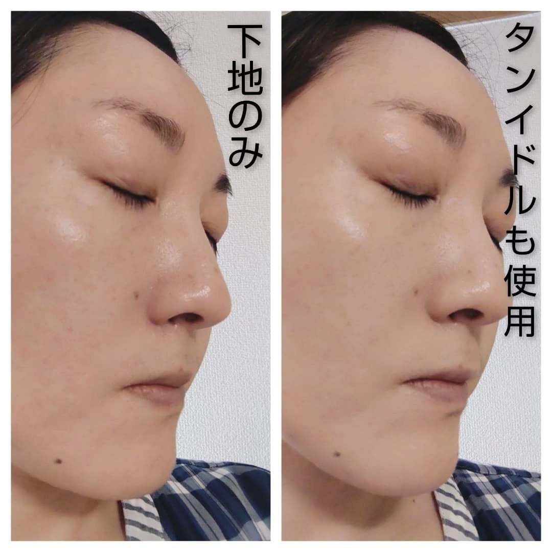 タンイドル ウルトラ ウェア リキッド N/LANCOME/リキッドファンデーションを使ったクチコミ(5枚目)