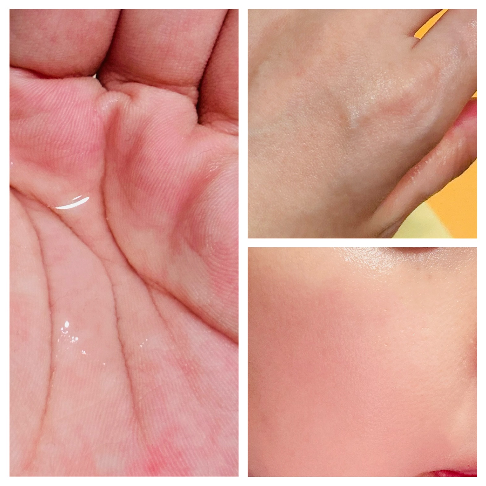 VC100エッセンスローション EX/ドクターシーラボⓇ/化粧水を使ったクチコミ（3枚目）