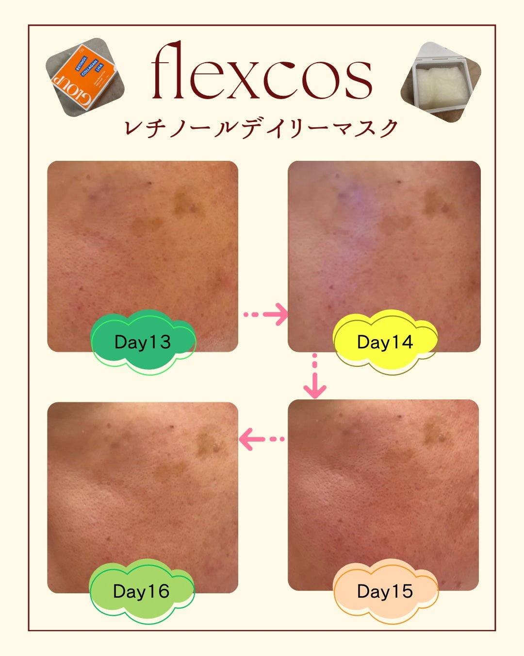 GLOUP DERMA RETINOL PLUS DAILY MASK/flexcos/シートマスク・パックを使ったクチコミ(8枚目)