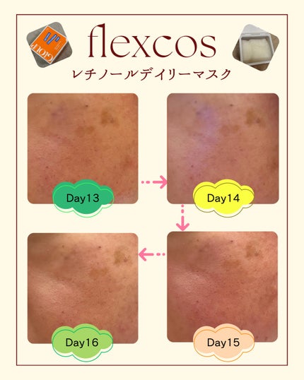 GLOUP DERMA RETINOL PLUS DAILY MASK/flexcos/シートマスク・パックを使ったクチコミ(8枚目)