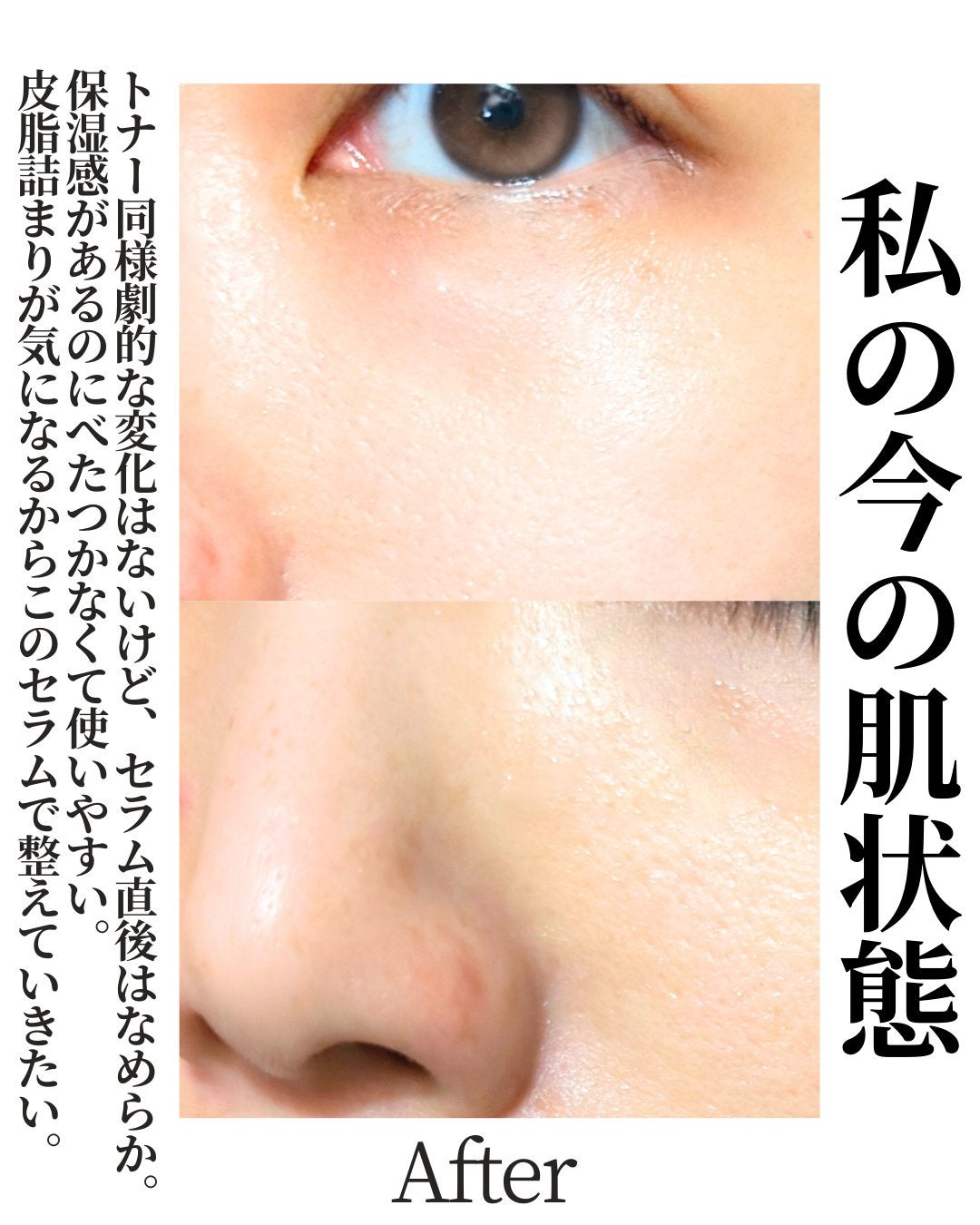 ダーマジェンシー ゼロカ81 セラム/DERMAGENCY/美容液を使ったクチコミ(3枚目)