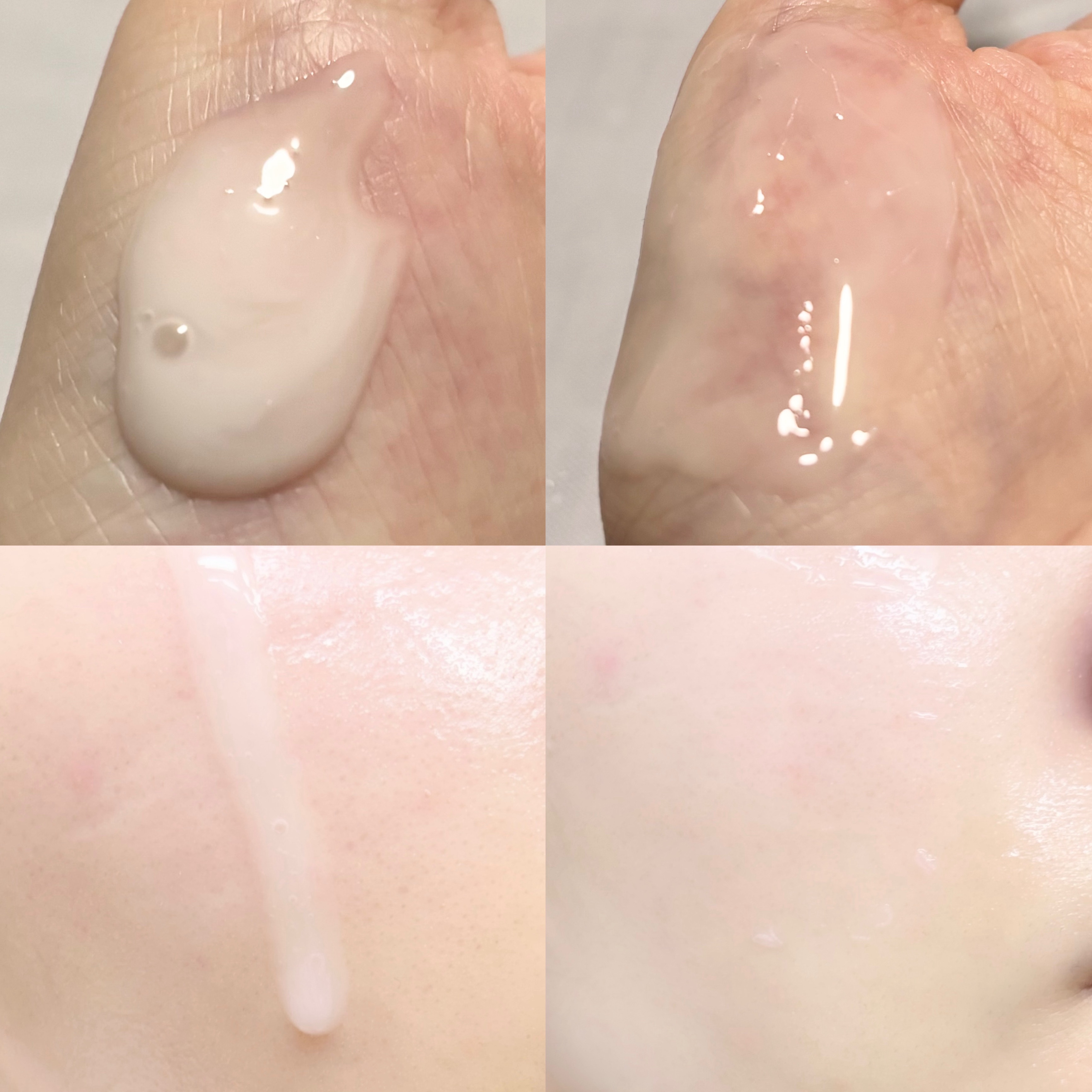 アップトックスアンプル/it:fu/美容液を使ったクチコミ（2枚目）