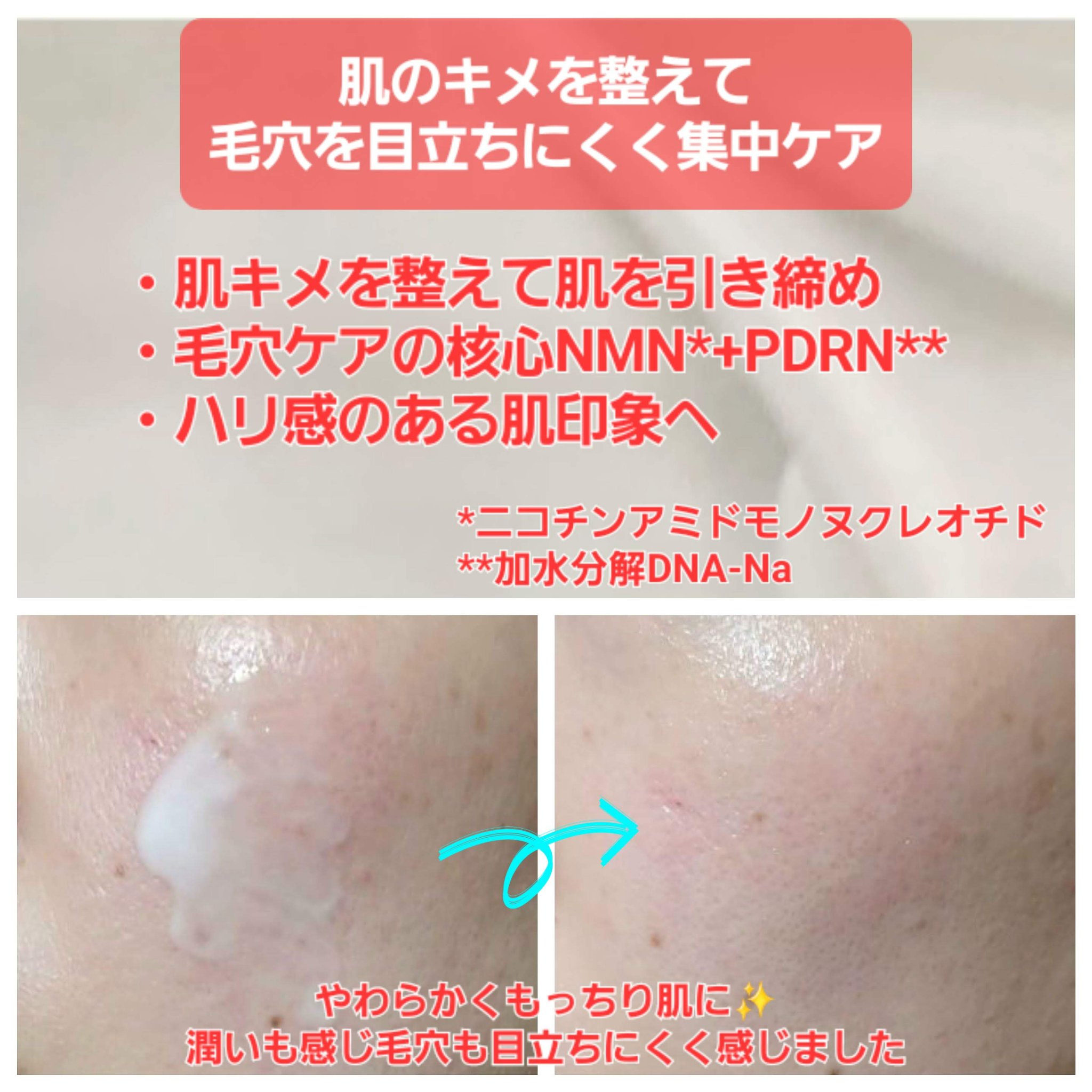 NMN-PDRN ダーマアンサー ポア ファーミング アンプル/CNP Laboratory/美容液を使ったクチコミ（3枚目）