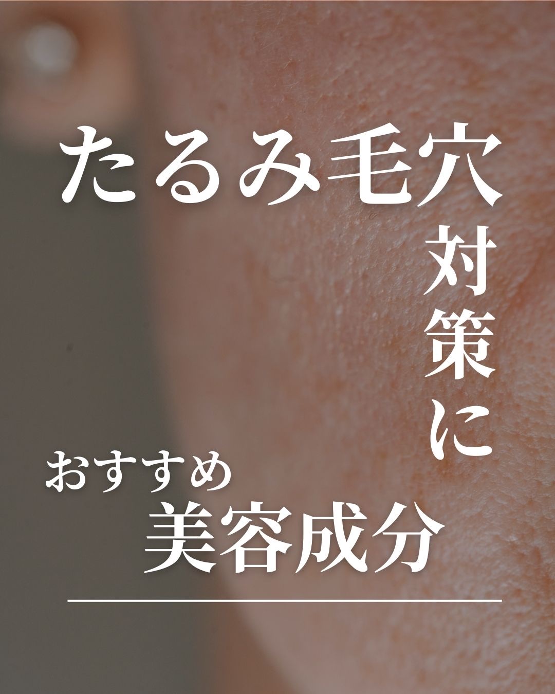＼たるみ毛穴対策に！／
＼おすすめ美容成分／

我々、40代・50代の世代だと、毛穴の中でもたるみ毛穴が気になってきます

今回は、たるみ毛穴対策におすすめの美容成分を紹介したいと思います。

たるみ毛穴にアプローチしながら、
エイジングサ
