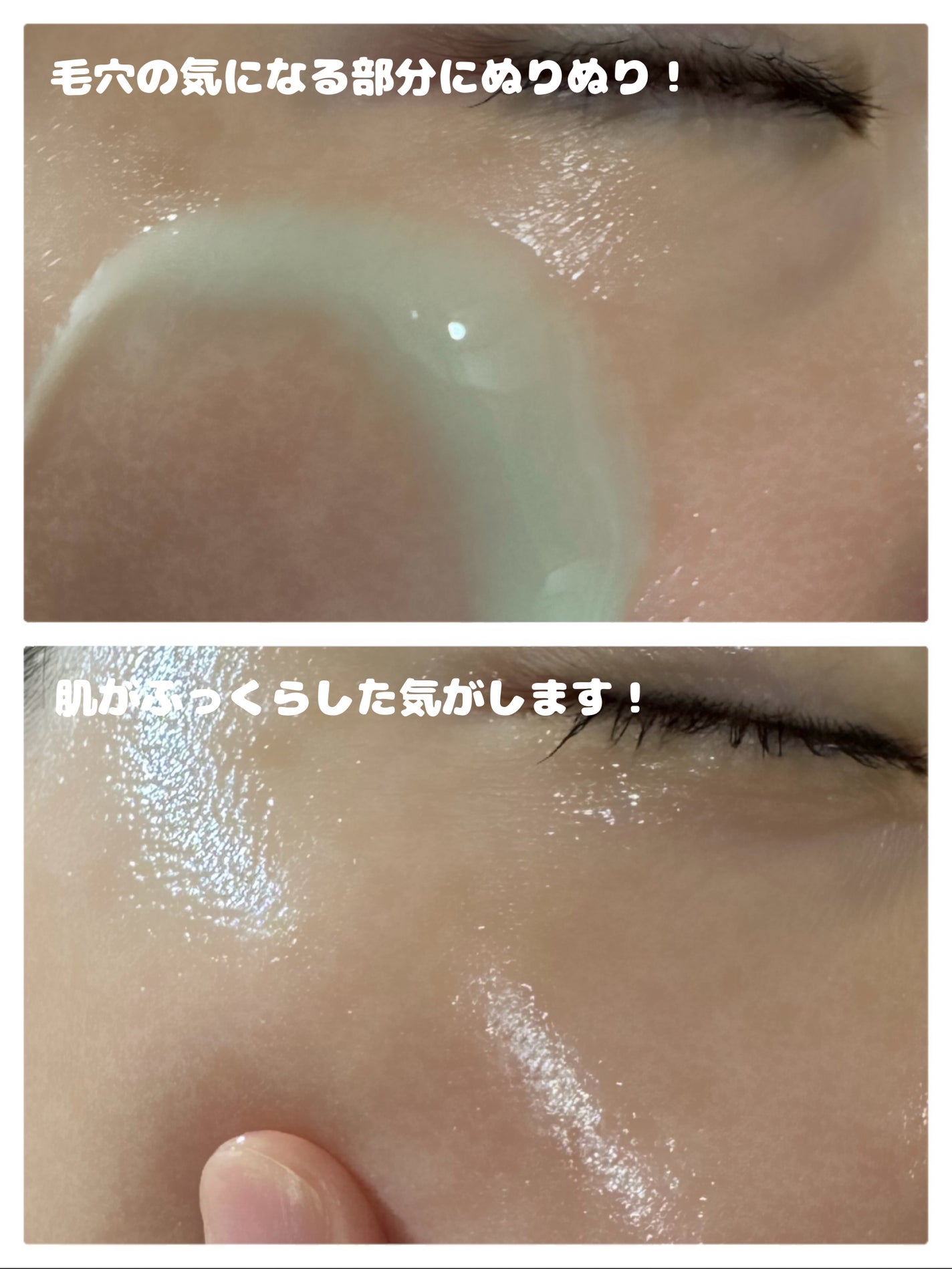 ReDRNエクソソームアンプル/Dr.nineteen/美容液を使ったクチコミ(4枚目)