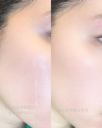 スムースリペアセラム/mileda/美容液を使ったクチコミ(4枚目)