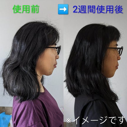 KAMIOTAS/フレージュ/頭皮ローションを使ったクチコミ(4枚目)