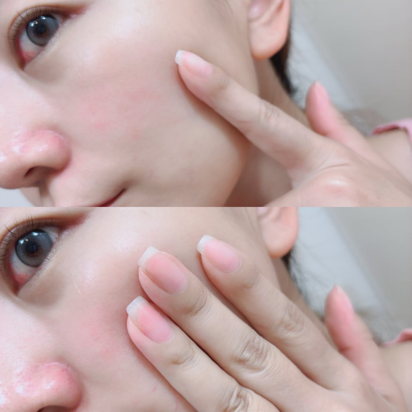 ダーマジェンシー ゼロカ86 トナー/DERMAGENCY/化粧水を使ったクチコミ(5枚目)