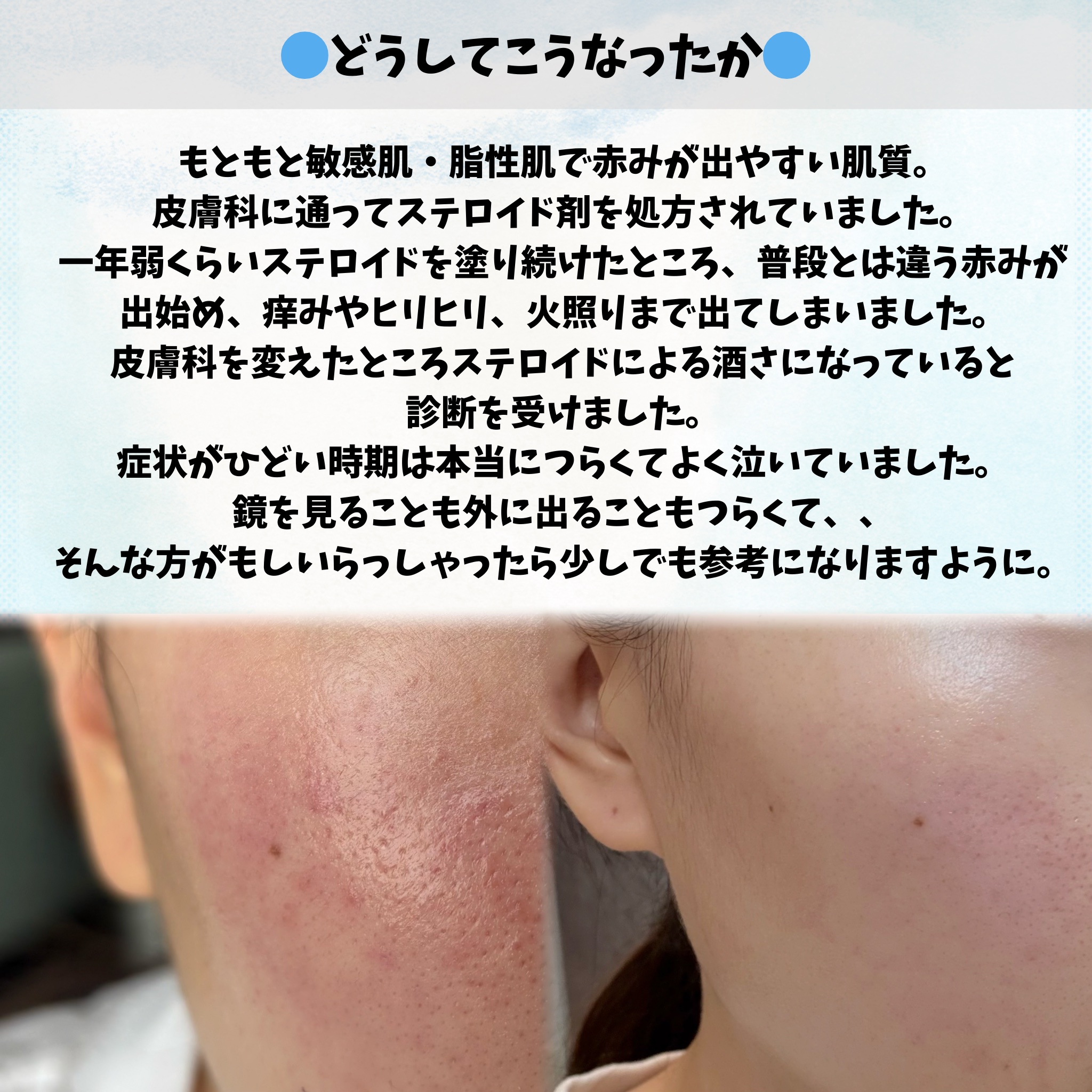 DHC 持続型ビタミンBミックス/DHC/美容サプリメントを使ったクチコミ（2枚目）