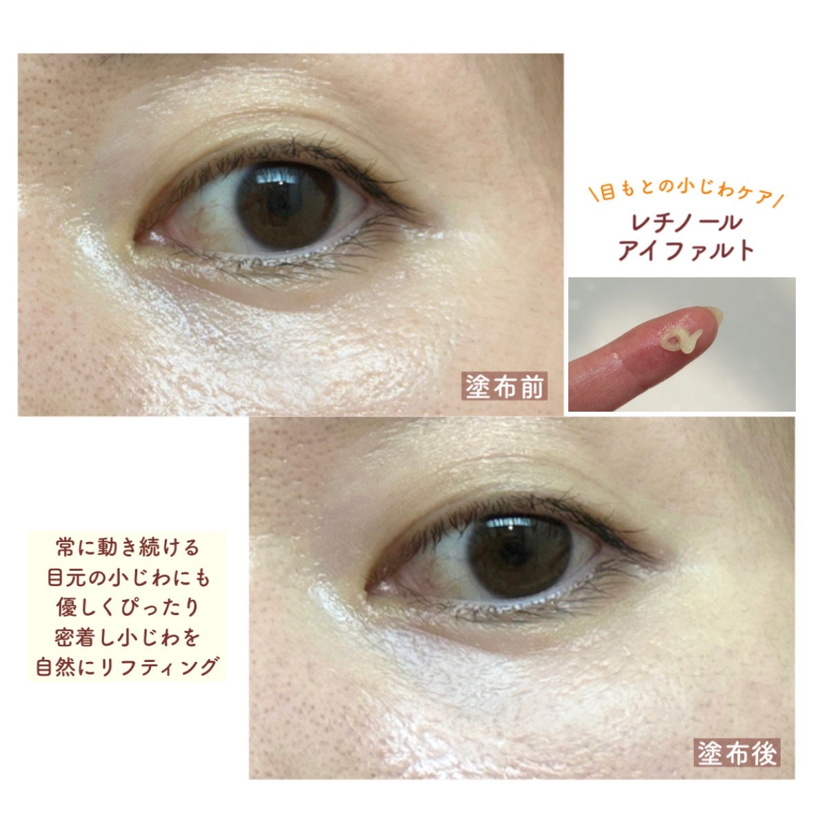 レチノールアイファルトアイバッククリーム/Dr.Melaxin/アイケア・アイクリームを使ったクチコミ(2枚目)