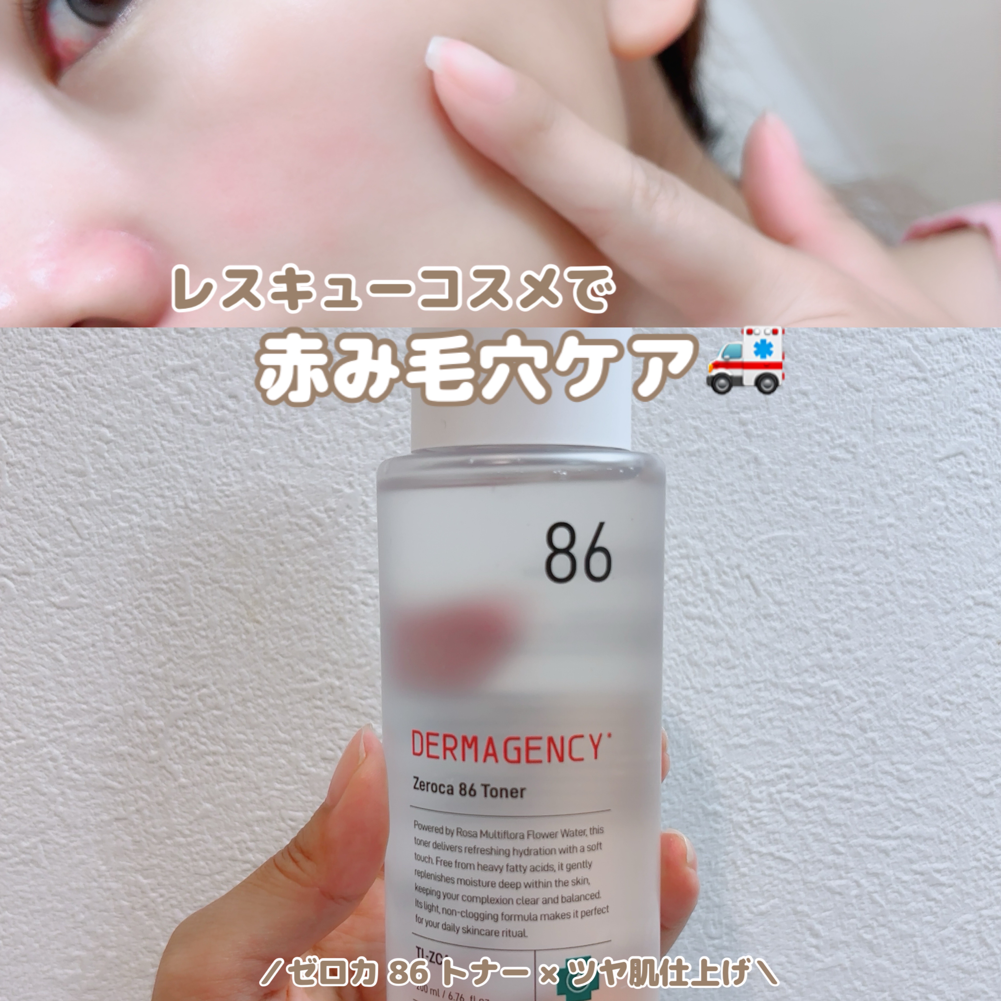 ダーマジェンシー ゼロカ86 トナー/DERMAGENCY/化粧水を使ったクチコミ（1枚目）