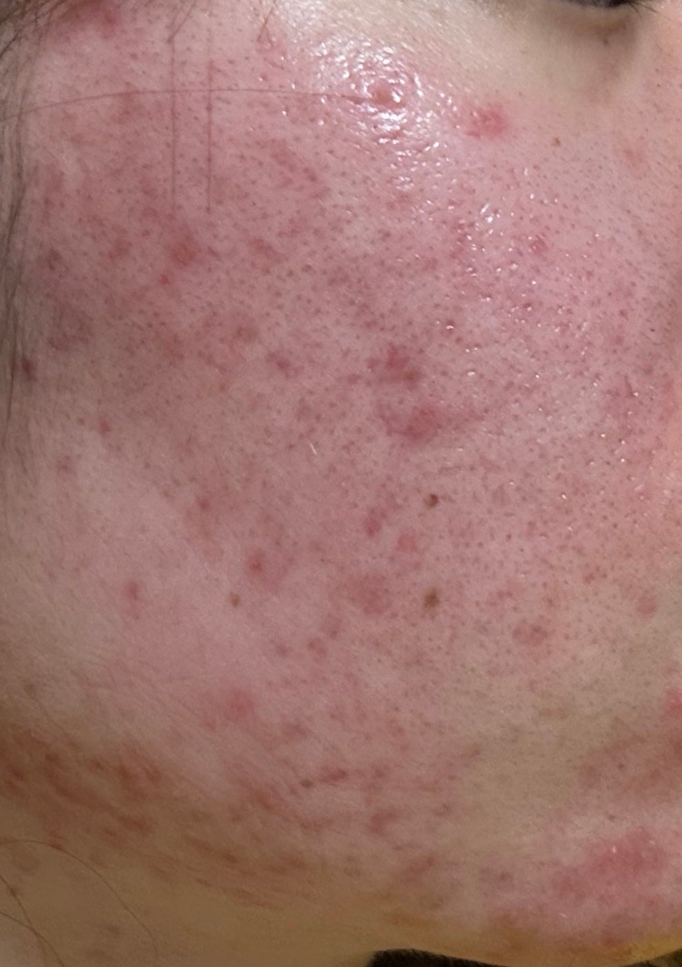 薬用泡洗顔/なめらか本舗/泡洗顔を使ったクチコミ(3枚目)