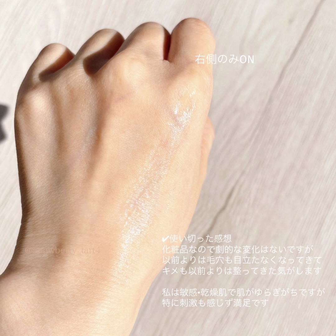 ポアマイジング フラッシュ アンプル/SKIN1004/美容液を使ったクチコミ（3枚目）