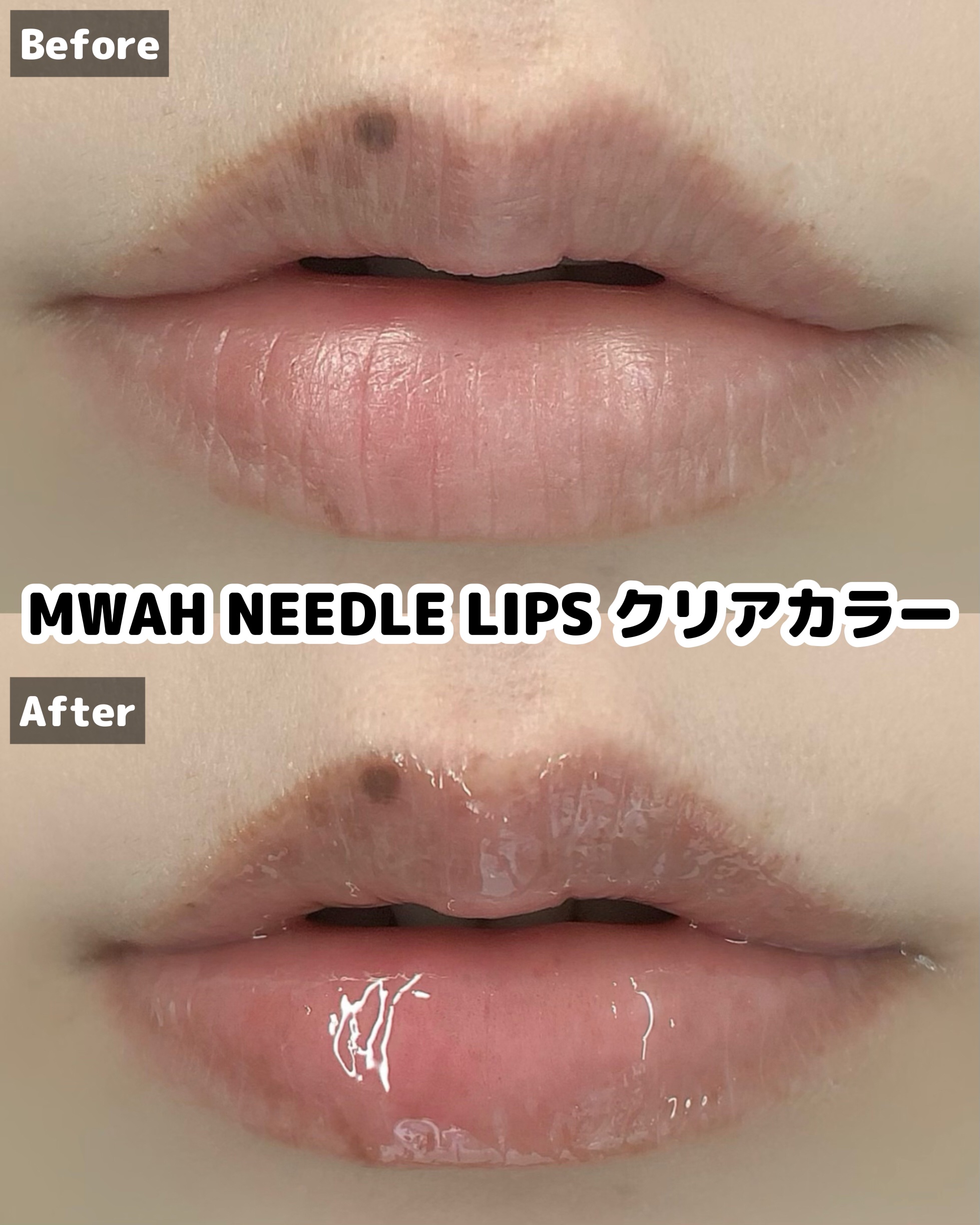 MWAH NEEDLE LIPS/MWAH/リッププランパーを使ったクチコミ（3枚目）