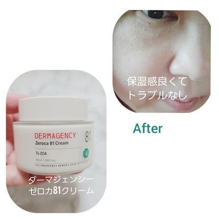 ダーマジェンシー ゼロカ81 クリーム/DERMAGENCY/フェイスクリームを使ったクチコミ(3枚目)