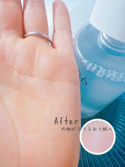 VC100エッセンスローション EX/ドクターシーラボⓇ/化粧水を使ったクチコミ(6枚目)