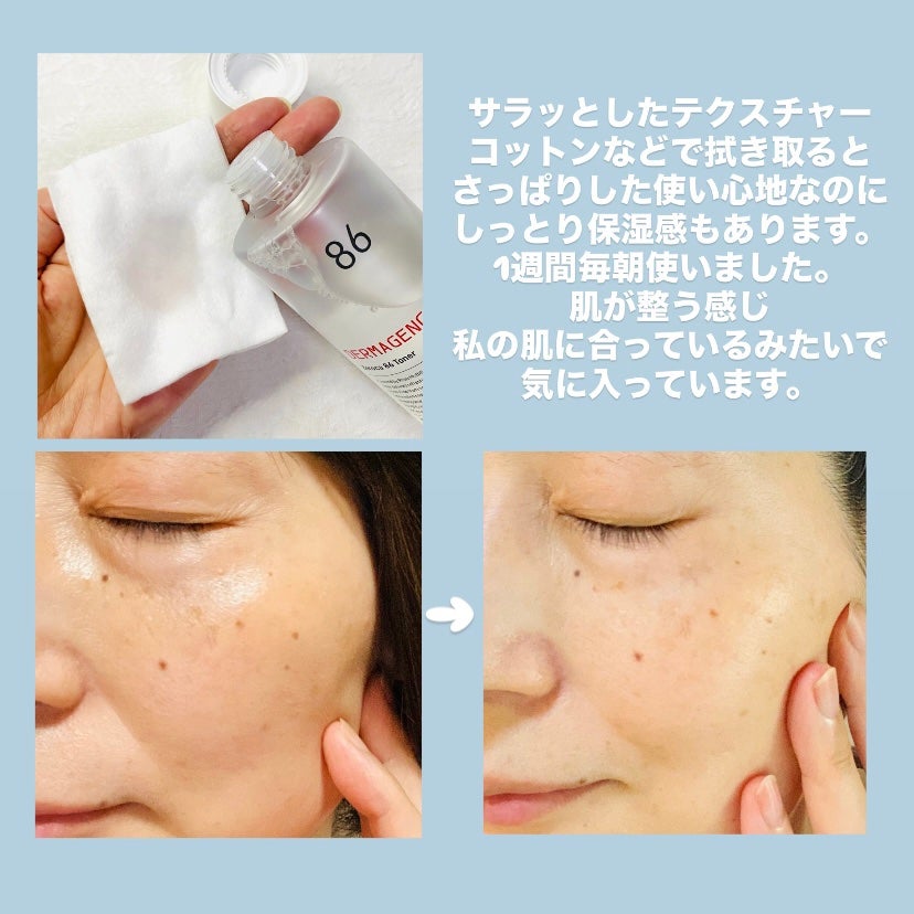 ダーマジェンシー ゼロカ86 トナー/DERMAGENCY/化粧水を使ったクチコミ(2枚目)