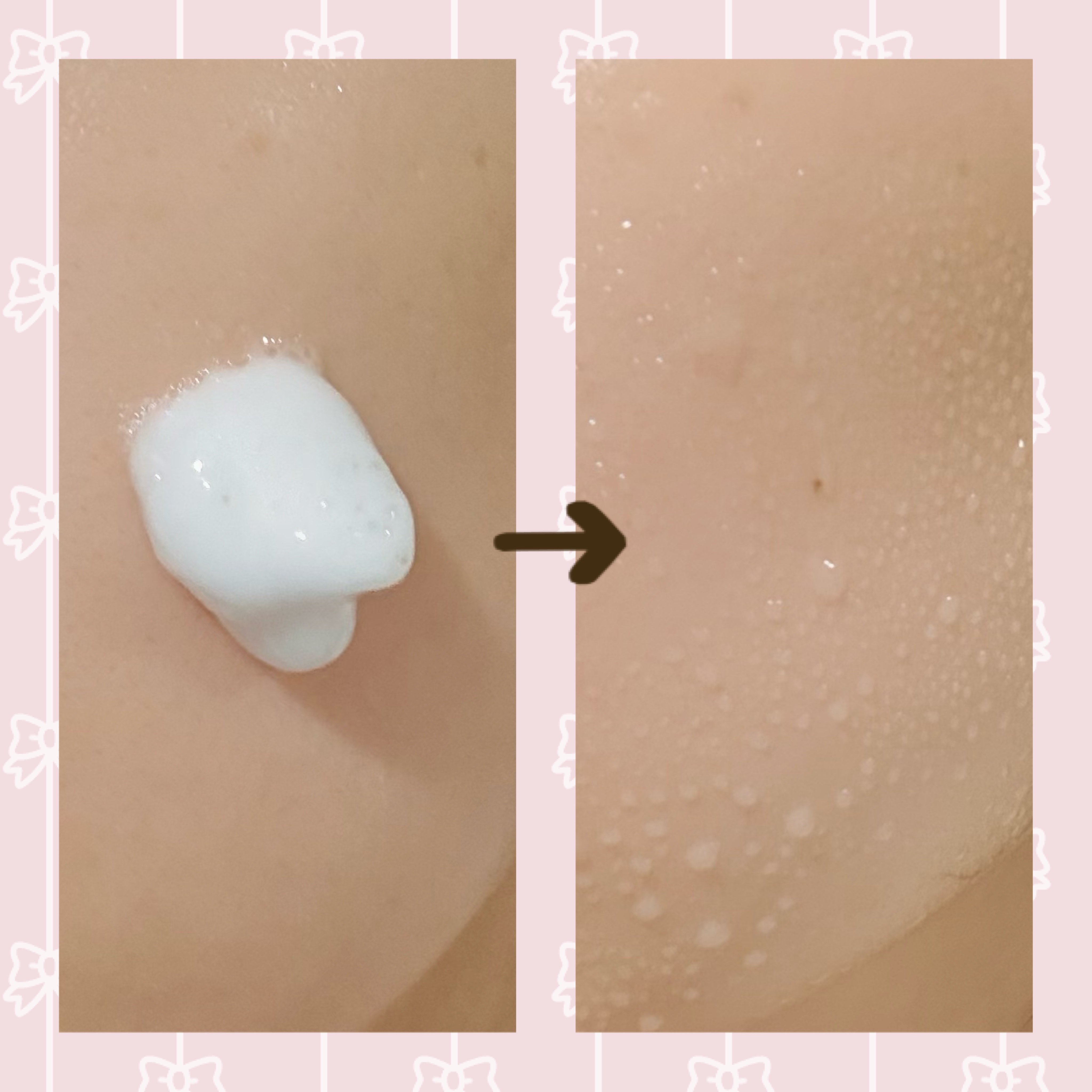 ソフィーナ iP 水光ピーリング泡セラム<ふきとり美容液>/SOFINA iP/美容液を使ったクチコミ（2枚目）