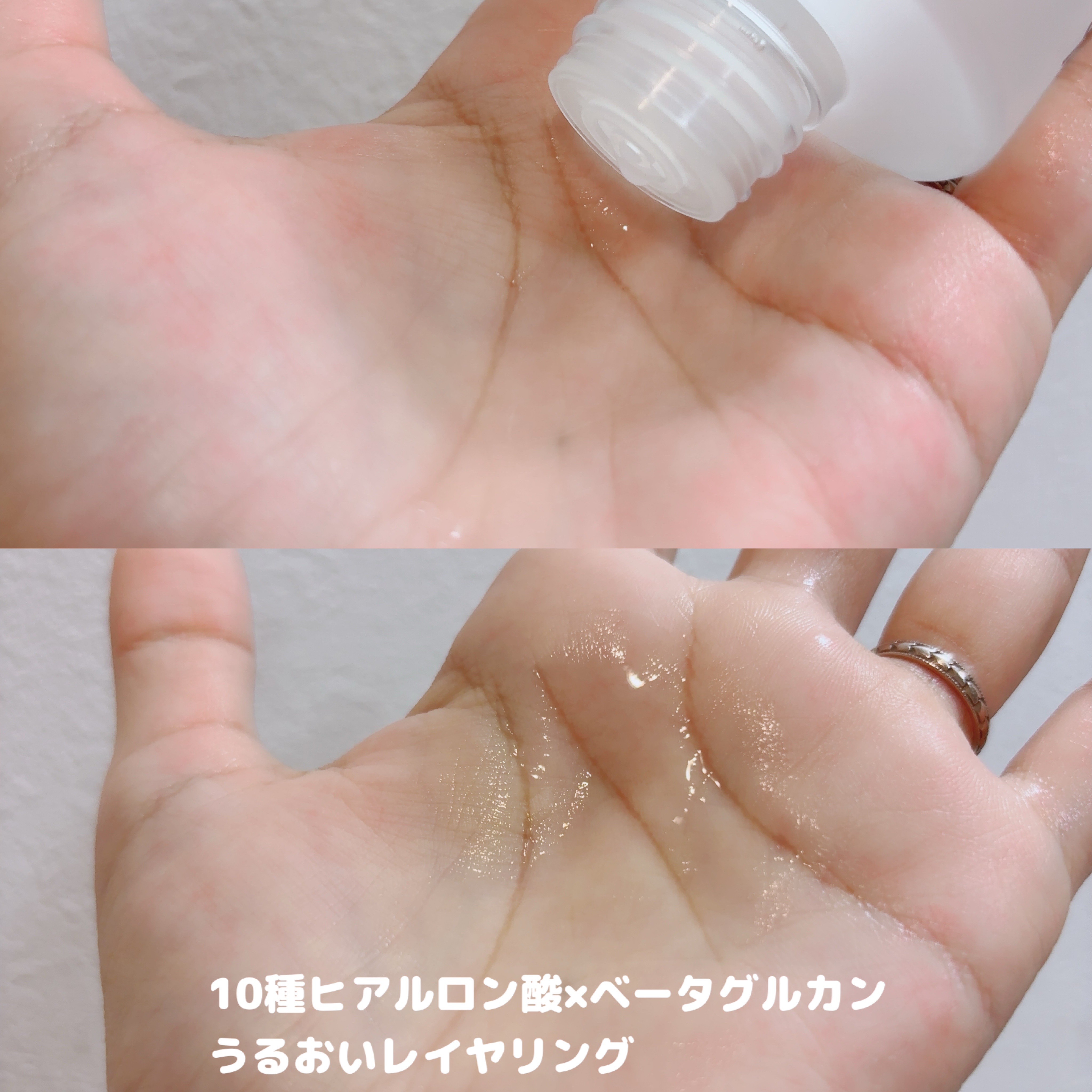 ダーマジェンシー ゼロカ86 トナー/DERMAGENCY/化粧水を使ったクチコミ（2枚目）