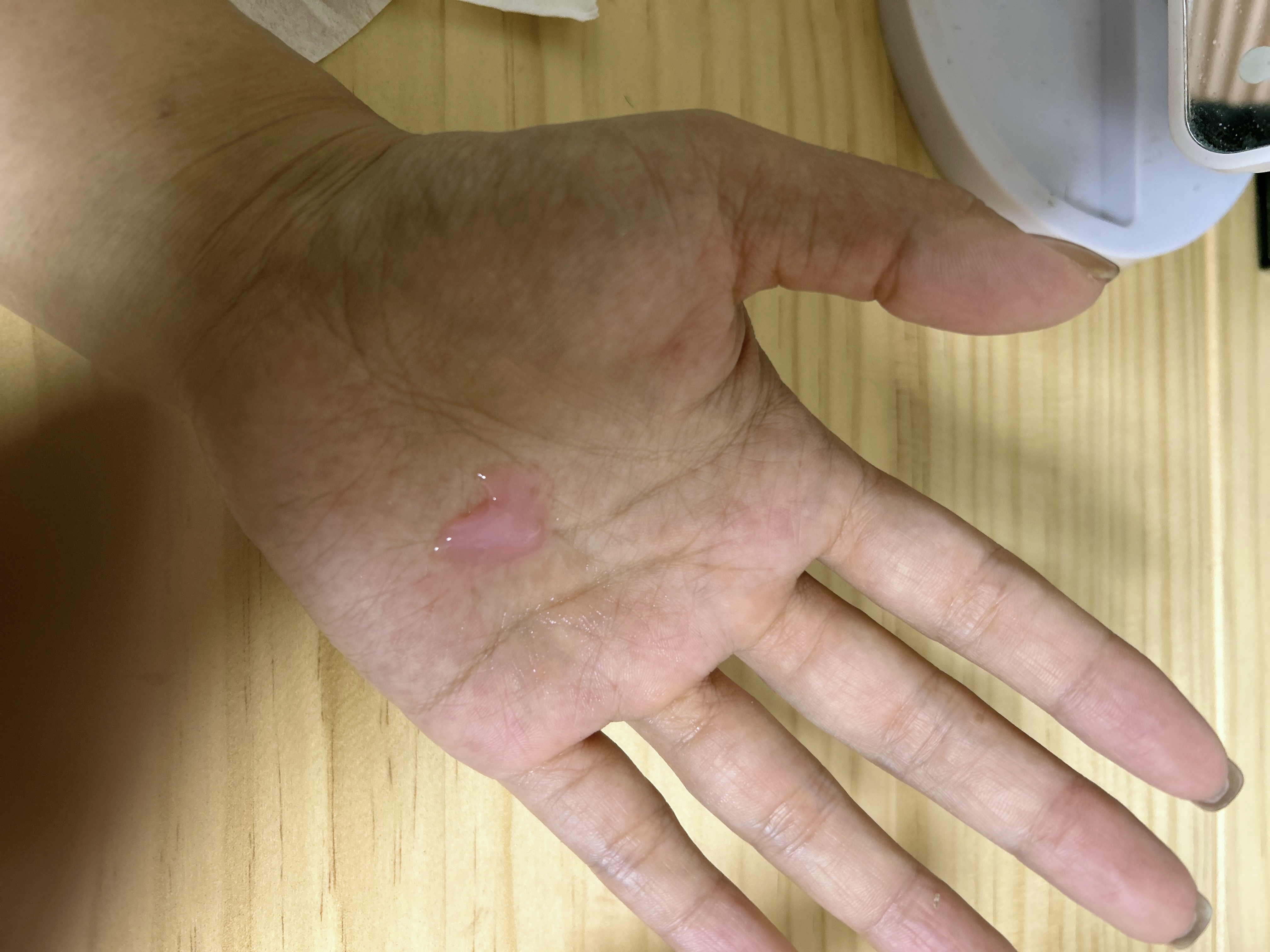 PDRNキューブセラム/DPPR/美容液を使ったクチコミ（3枚目）