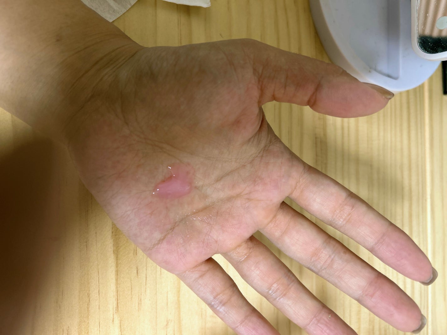 PDRNキューブセラム/DPPR/美容液を使ったクチコミ(3枚目)