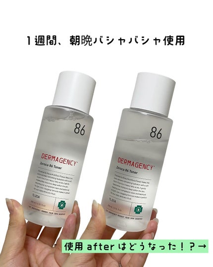 ダーマジェンシー ゼロカ86 トナー/DERMAGENCY/化粧水を使ったクチコミ(3枚目)