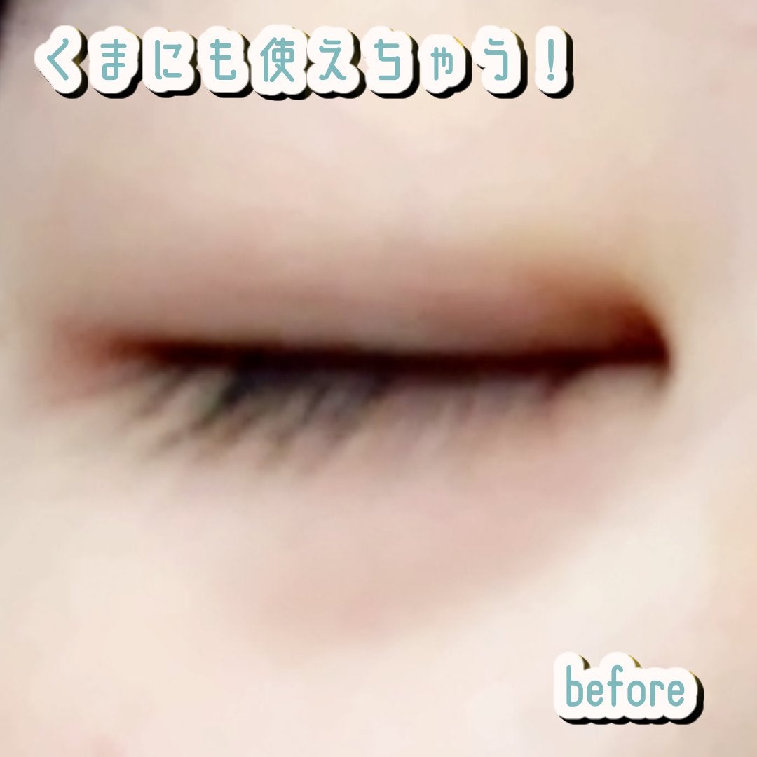 薬用スポットシーラークリーム/スキンヒーロー/クリームコンシーラーを使ったクチコミ(3枚目)