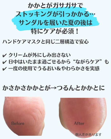 ガサガサかかとをしっとり包む お手入れ底上げ かかとケアマスク/キュレル/レッグ・フットケアを使ったクチコミ(3枚目)