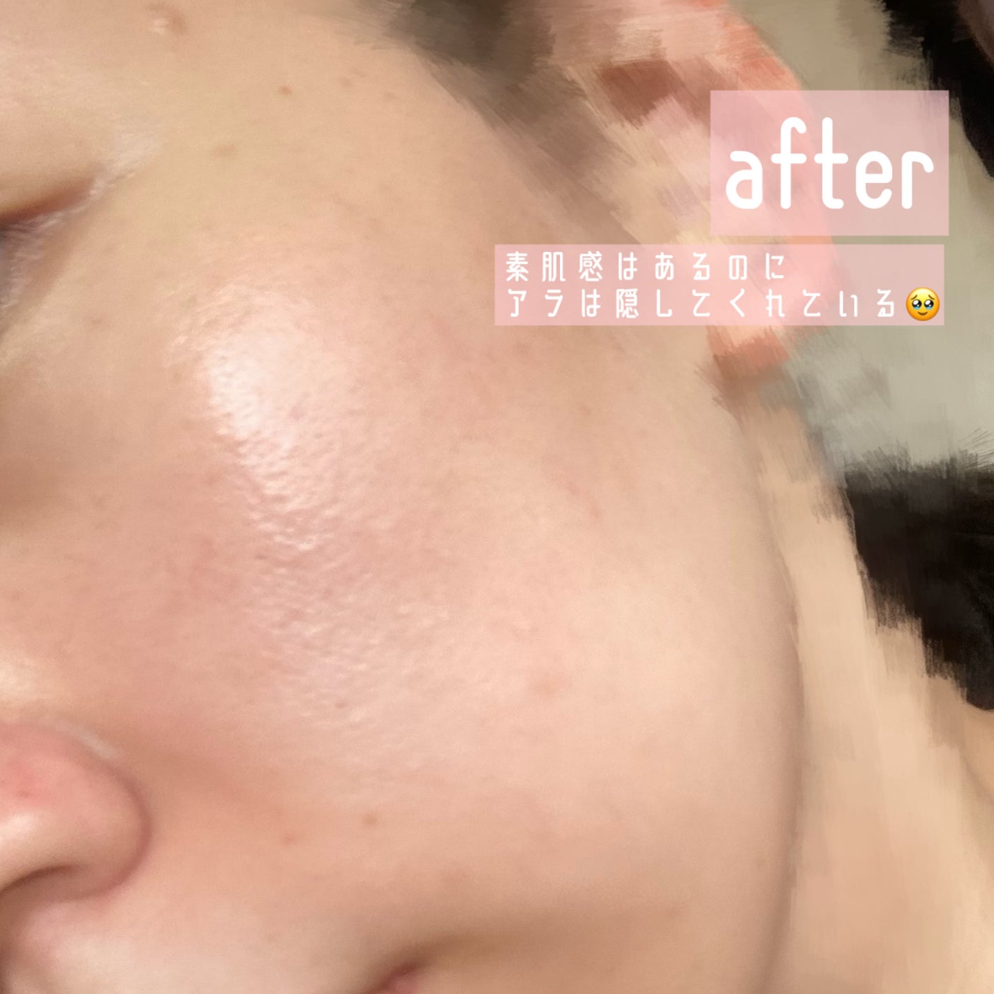 UVã€ã㢠XL ãããã¯ã·ã§ã³ããŒã³ã¢ãã ããŒãº+/ã© ããã·ã¥ ããŒ/æ¥çŒãæ¢ãã»UVã±ã¢ã䜿ã£ãã¯ãã³ãïŒ4æç®ïŒ