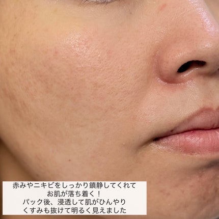 ティーツリーエッセンシャルマスク 1枚/MEDIHEAL/シートマスク・パックの画像