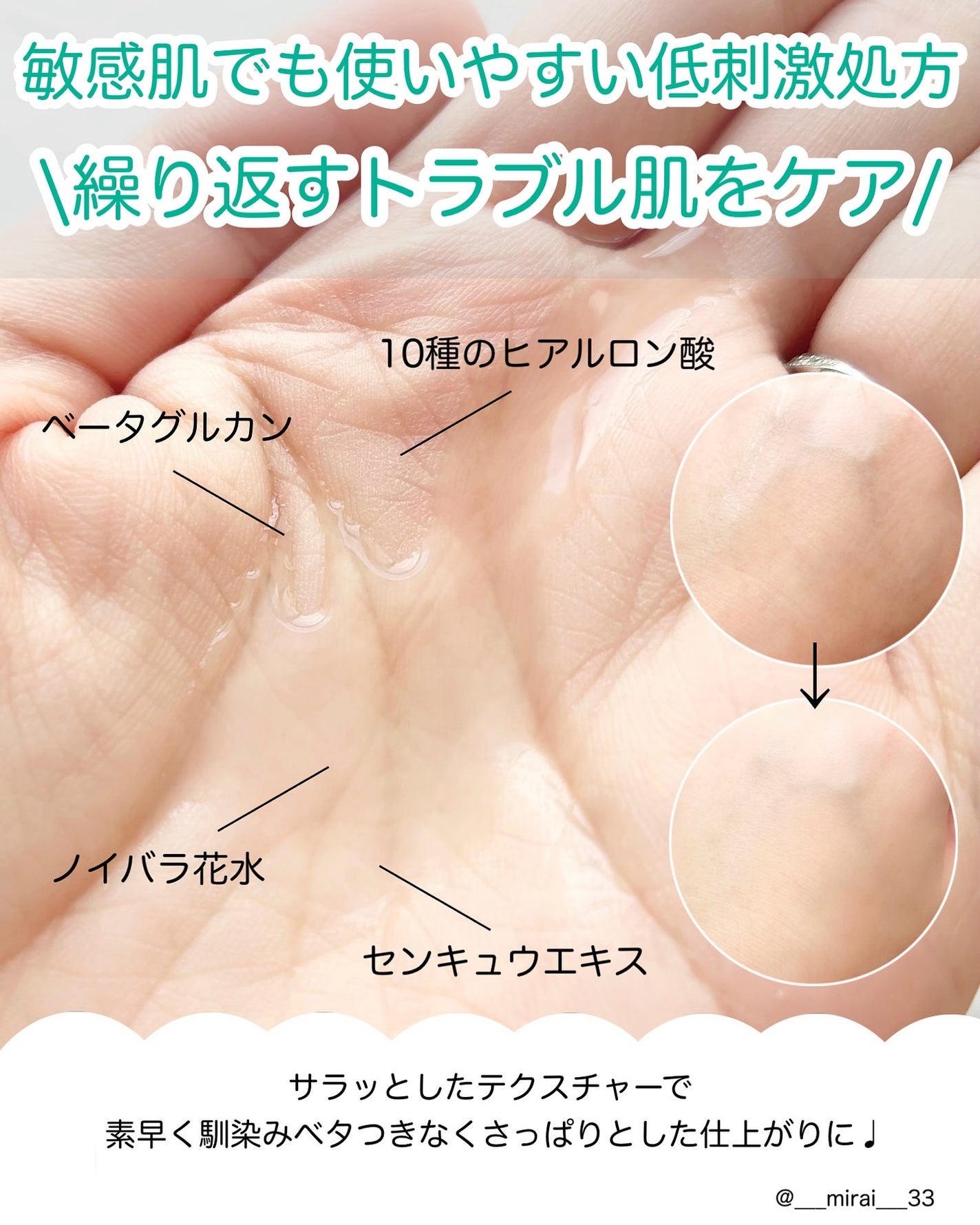 ダーマジェンシー ゼロカ86 トナー/DERMAGENCY/化粧水を使ったクチコミ(3枚目)