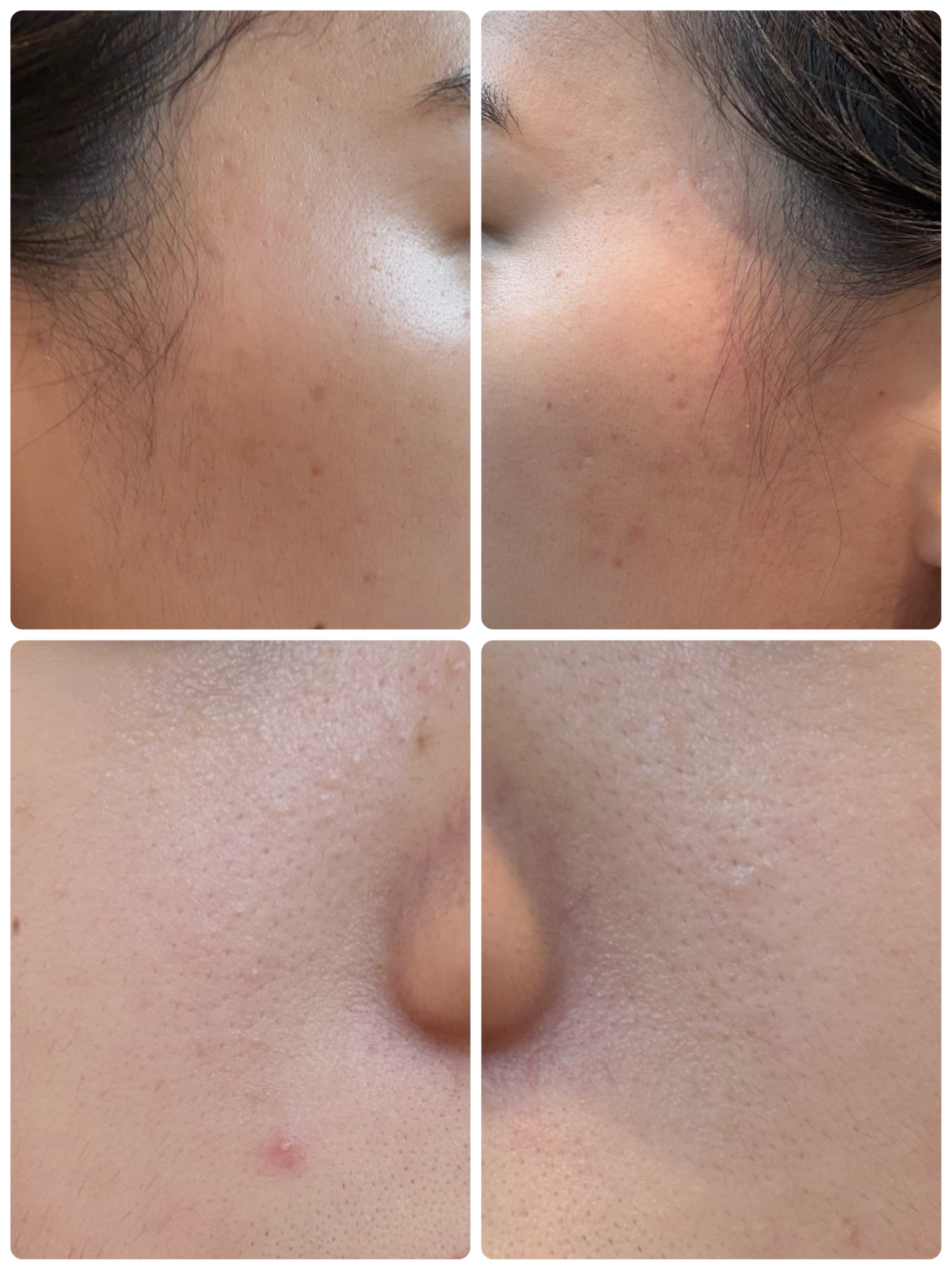 薬用雪肌精 ブライトニング クレンジング オイル[医薬部外品]/雪肌精/オイルクレンジングを使ったクチコミ（2枚目）