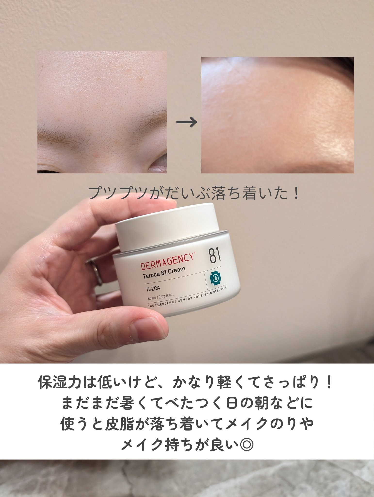 ダーマジェンシー ゼロカ81 クリーム/DERMAGENCY/フェイスクリームを使ったクチコミ（2枚目）